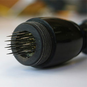 Baunscheidt’s Lebenswecker or "artificial leech"