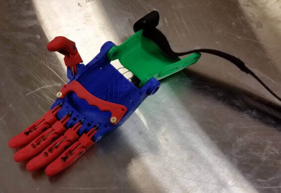 3D printed prosthetic Hand