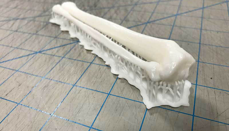 3D printed fibula and tibia