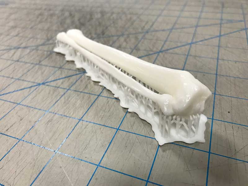 Fibula Tibia 3D print