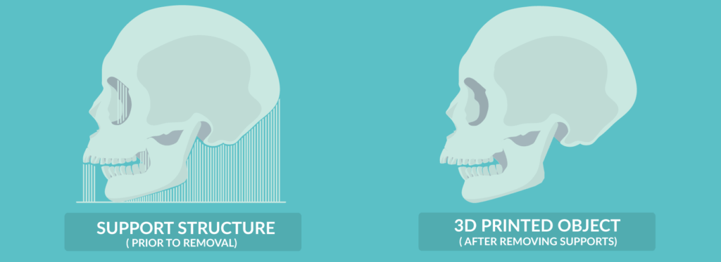 Comparison of 3D printed model with and without support structure