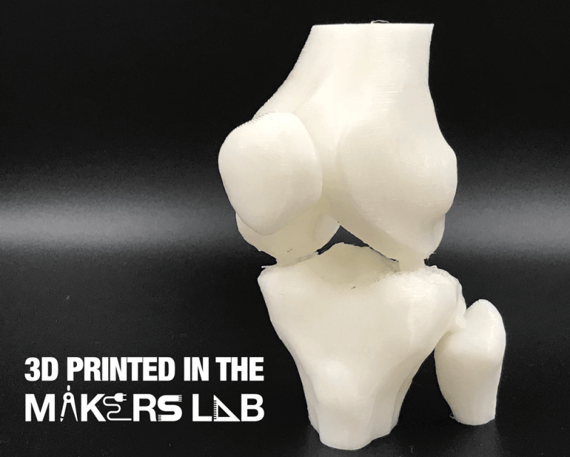 3d printed knee