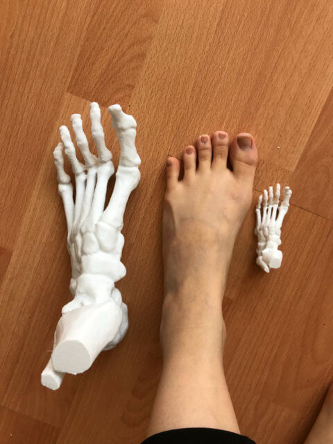 3D printed foot