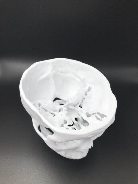 3D printed skull