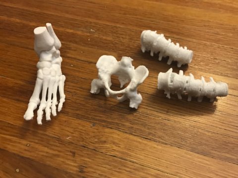 3D printed spine, foot and pelvis