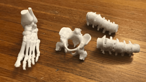 3d printed anatomical models