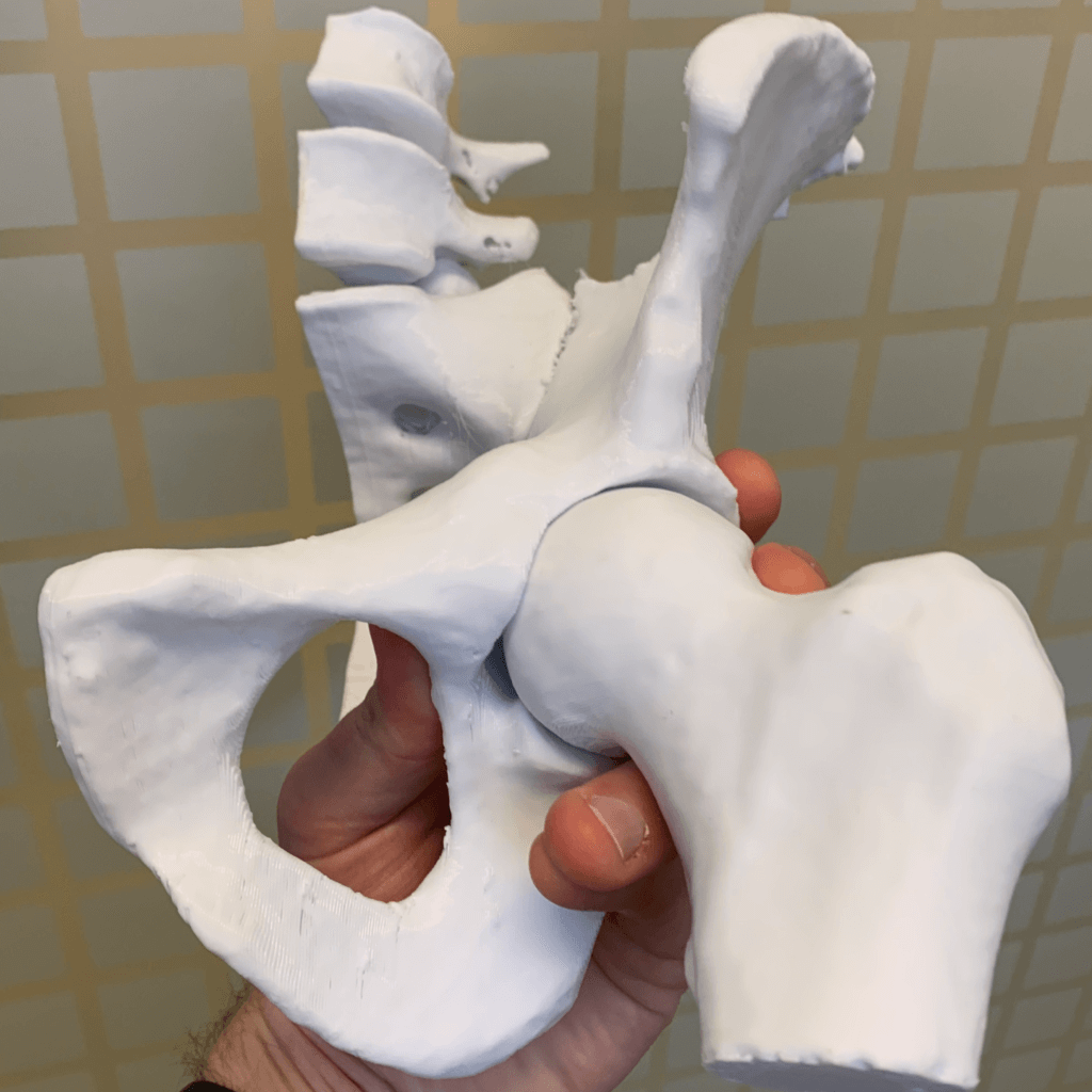 3D printed pelvis model