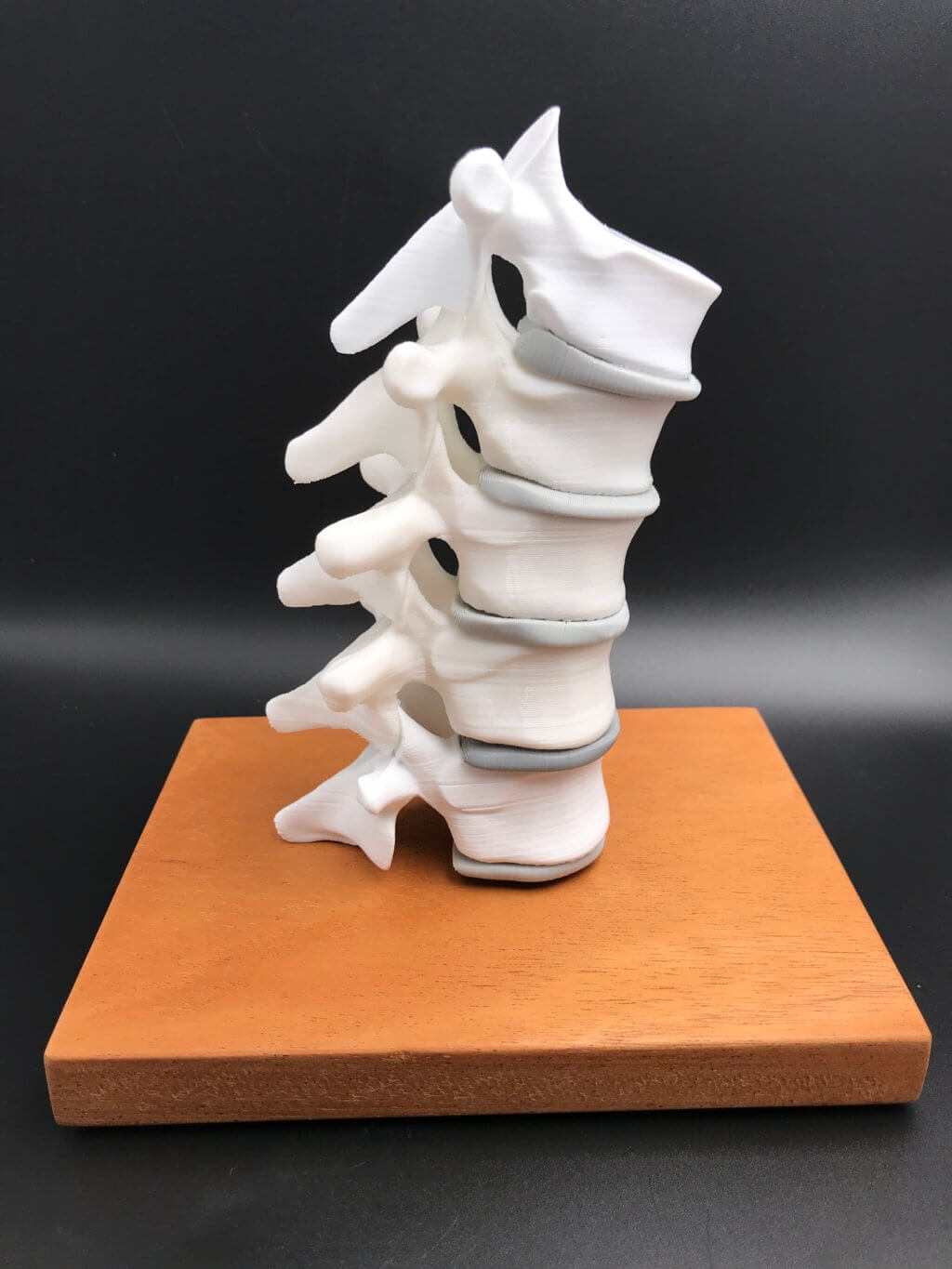 3D printed spine
