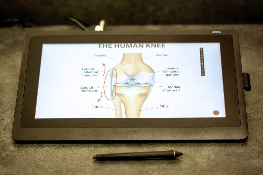 wacom tablet monitor