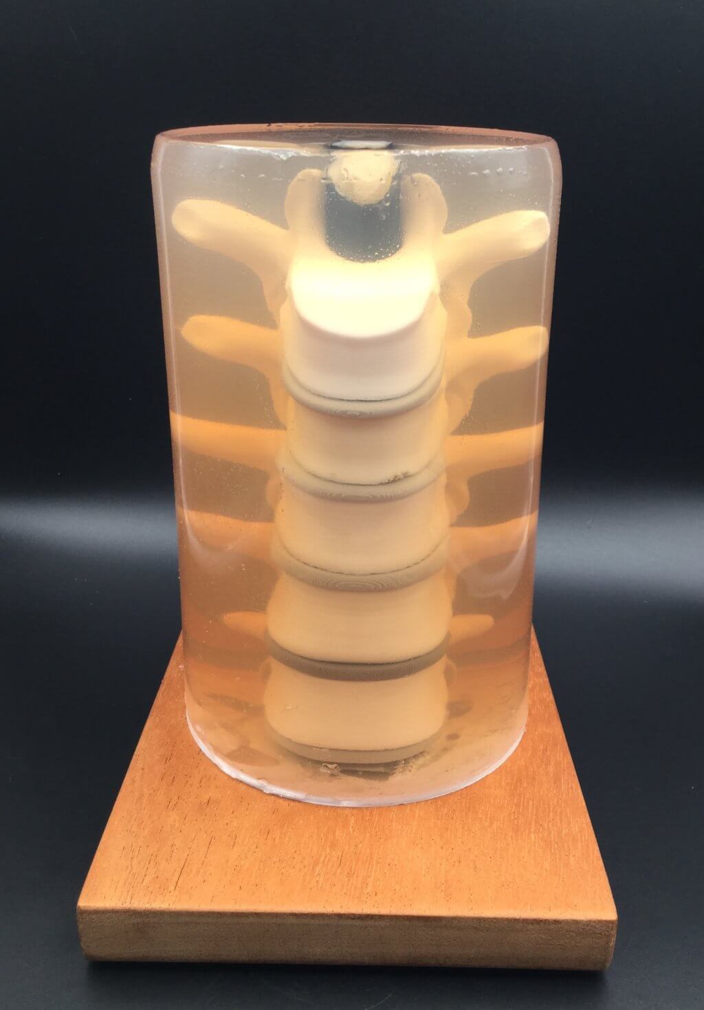 3D printed spine in gelatin enclosure
