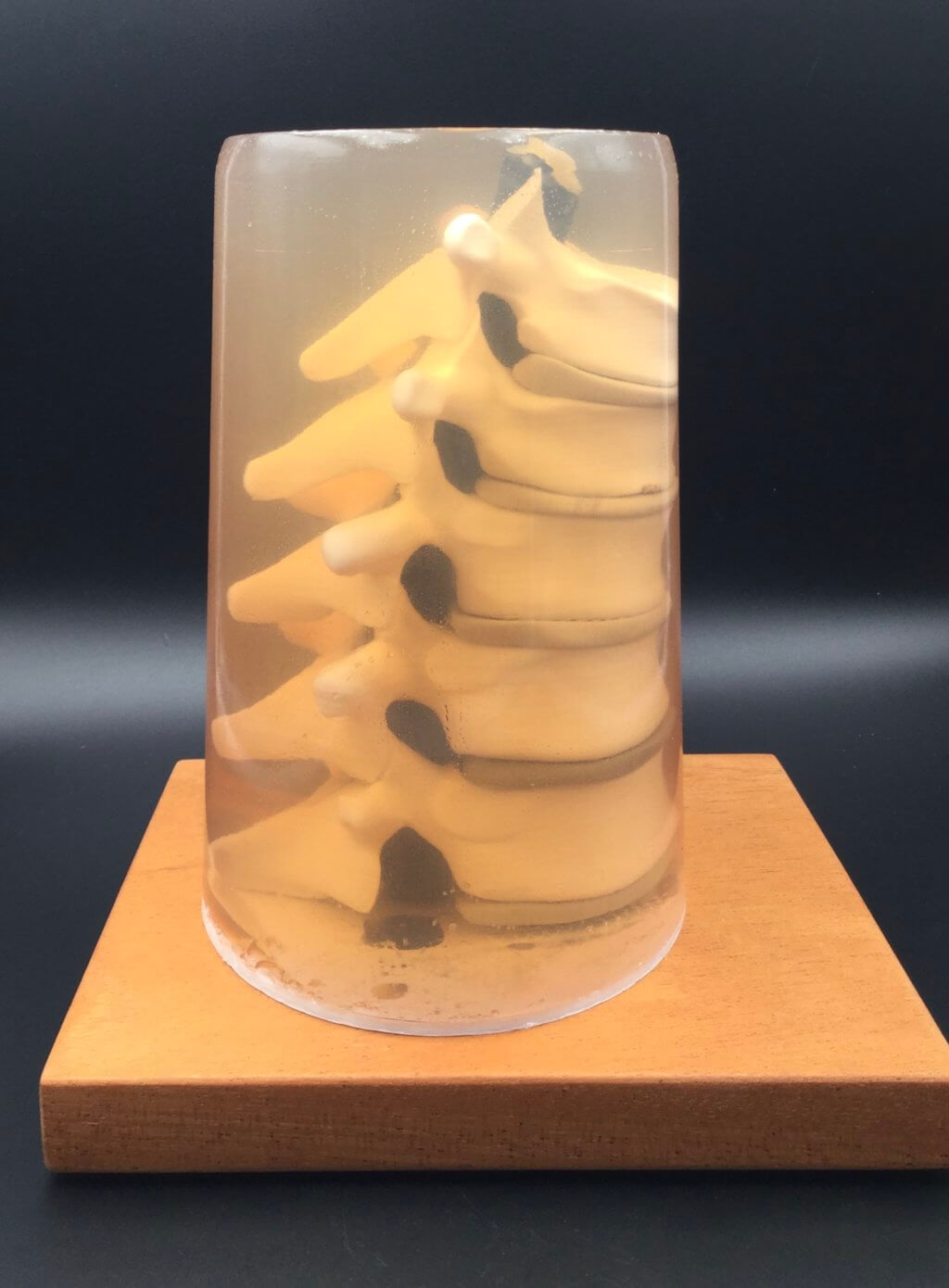 3D printed spine in gelatin enclosure