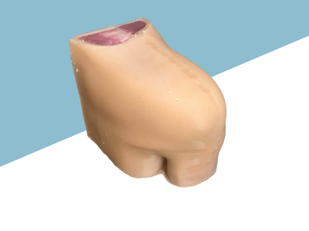 Prototype 1 of glenohumeral 3D printed proejct