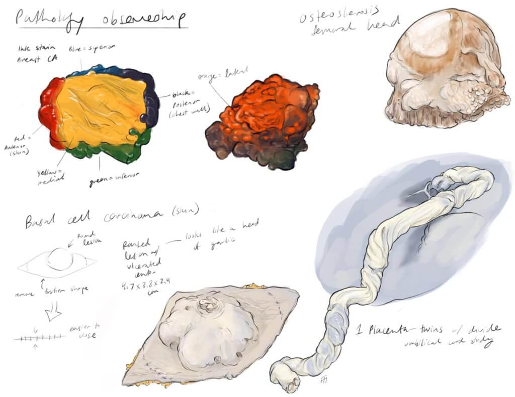 Pathology Observational Sketches 