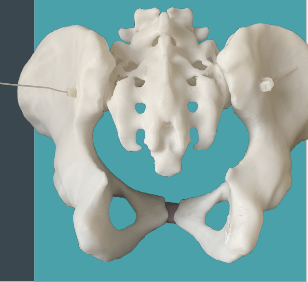 3D Printed Midwifery Pelvis