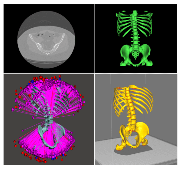CT scans to 3D models