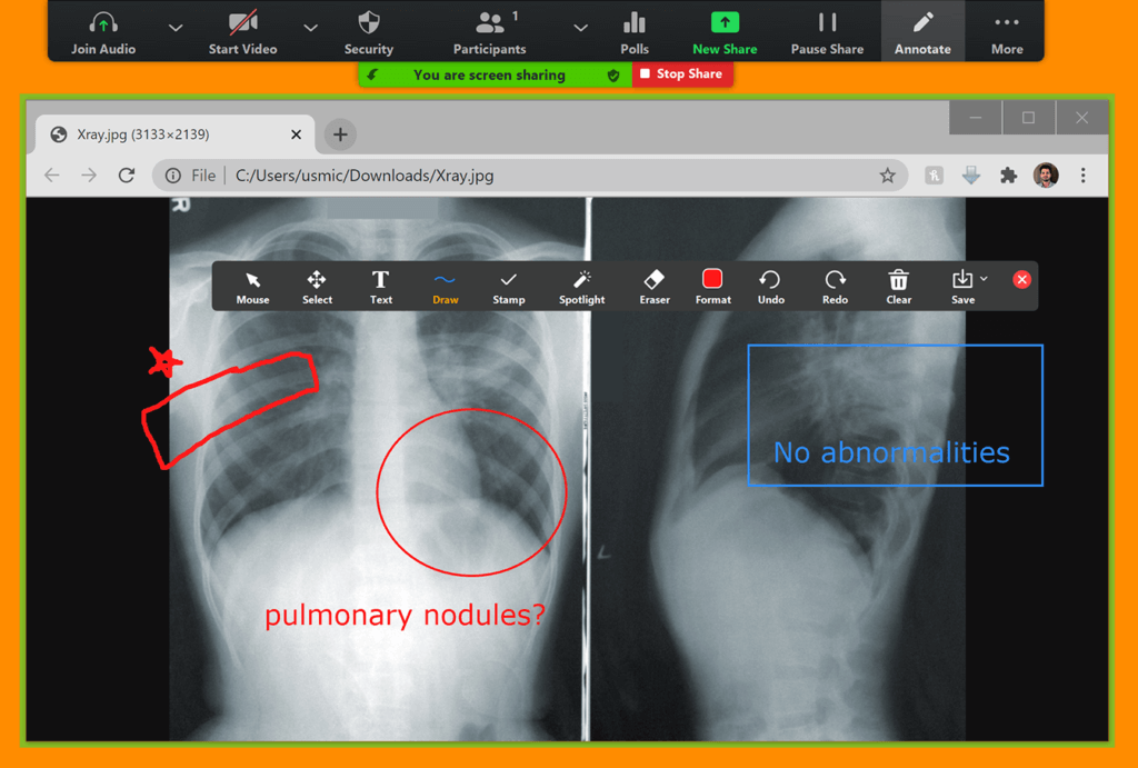 Annotates xrays