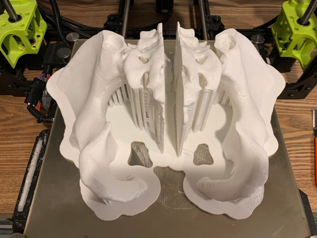 3D printed female pelvis model