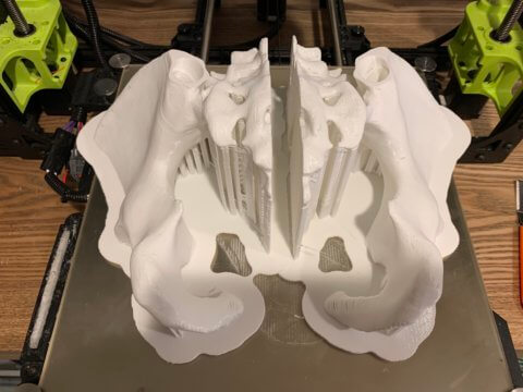 3D printed female pelvis model