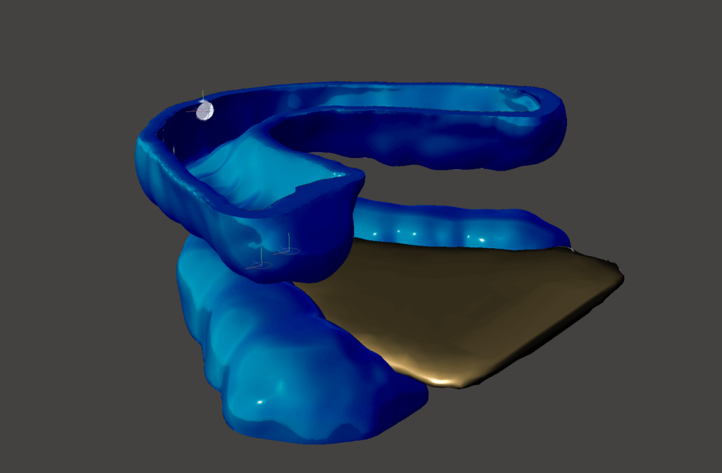 3D model of intraoral stent and dental guards in Meshmixer