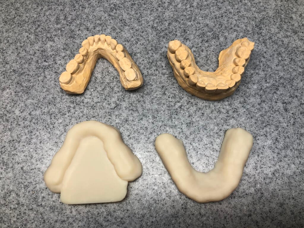 Assortment of dental casts and resin 3D printed intraoral stent guards