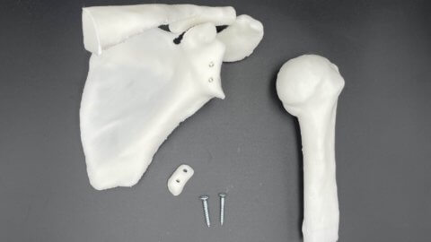3D printed shoulder model