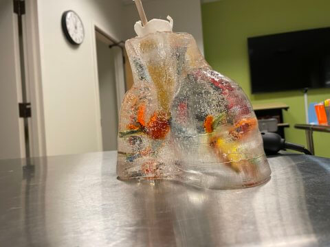 Bronchial tree encased in Humimic Gel
