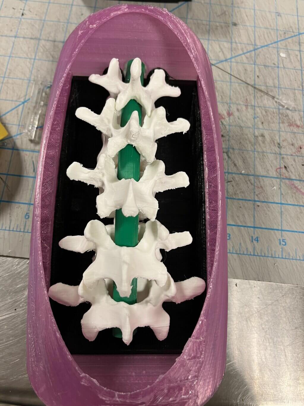 LP simulator before using silicone to fix vertebrae model in place.