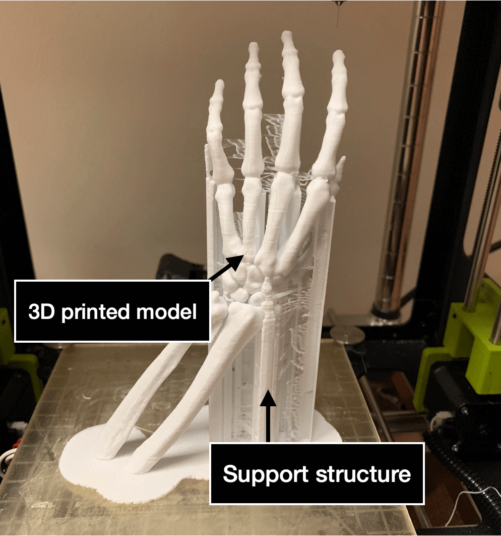 3D printed model of hand and wrist with support structure attached.