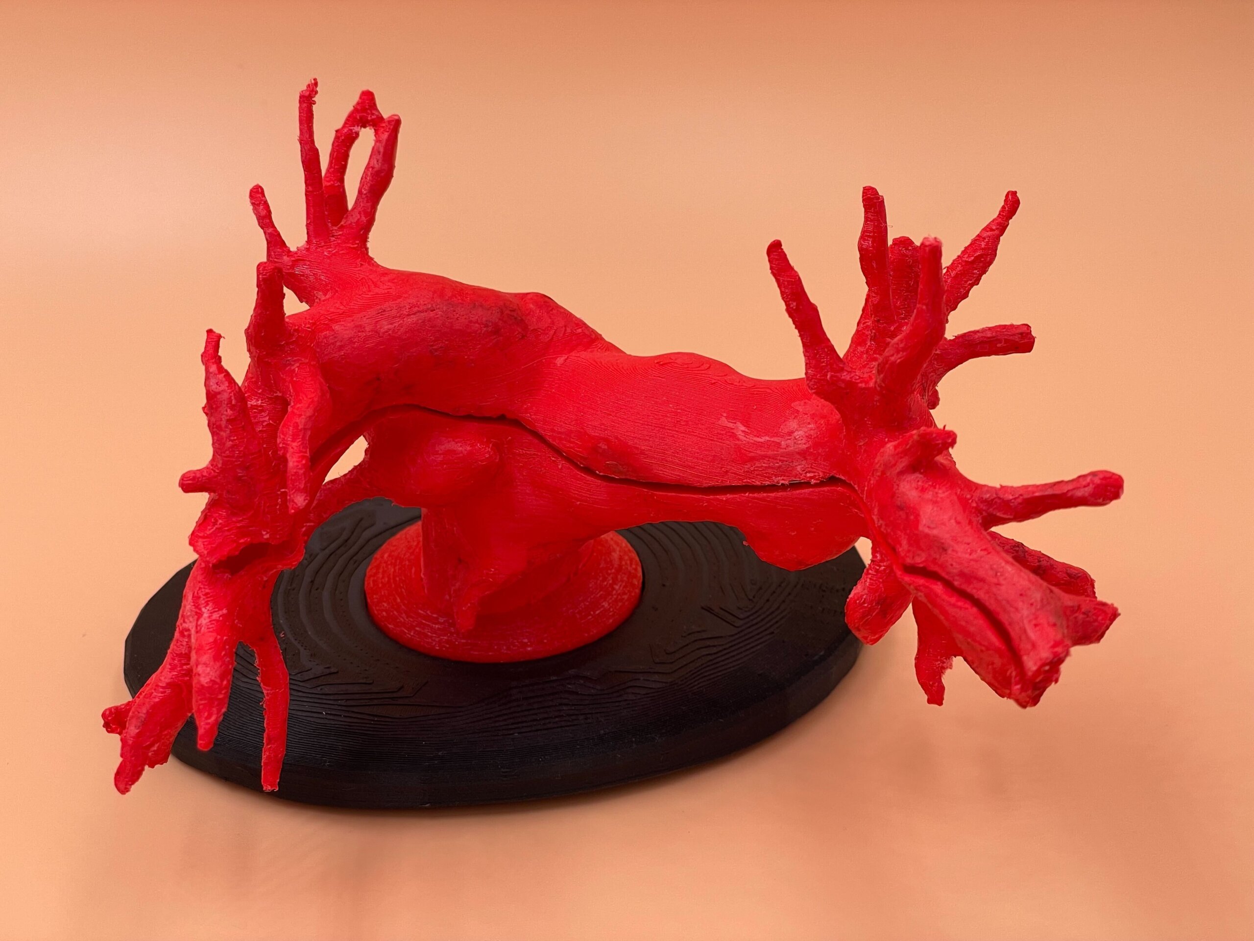 3D printed model of the pulmonary arteries