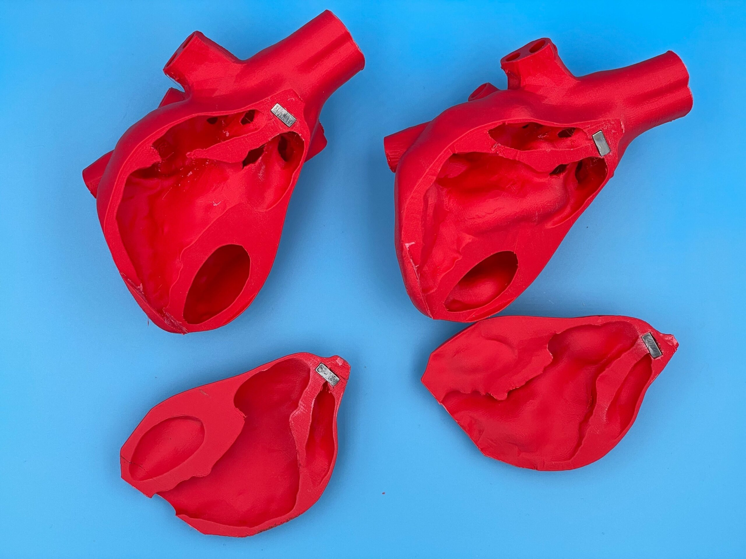 One normal heart 3D printed model and one 3D printed heart model reflecting pathological changes due to pulmonary HTN