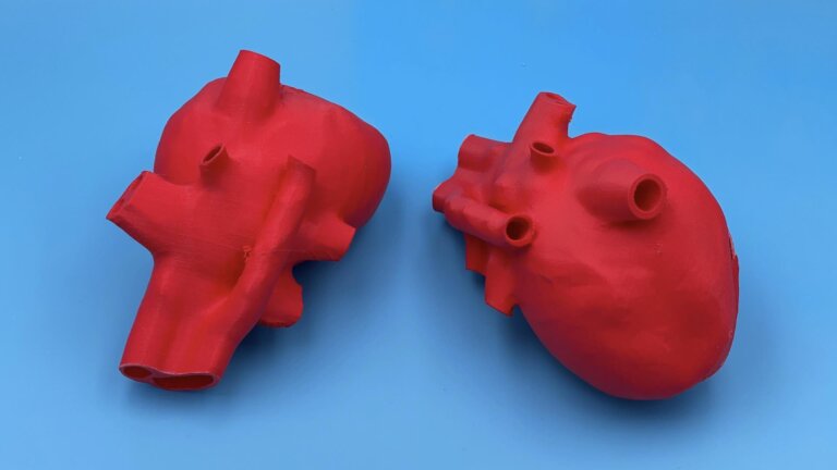 3D printed model of a heart