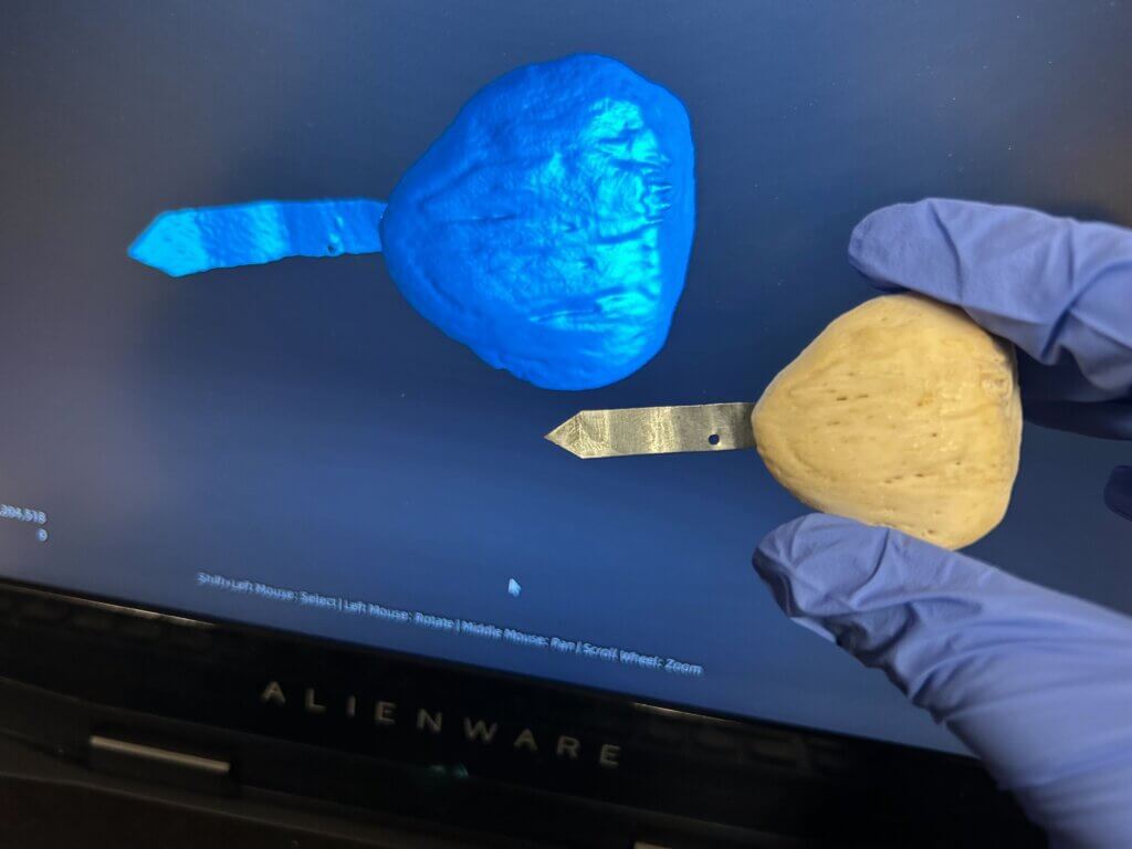 3D scan and patella bone