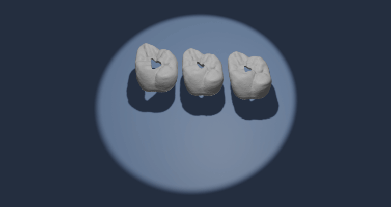 Dental guide render