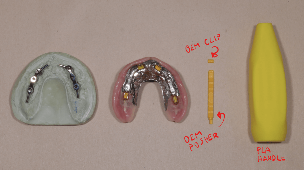 Dental models with sterile OEM pusher, sterile OEM retentive clip, and PLA (3D-printed) handle