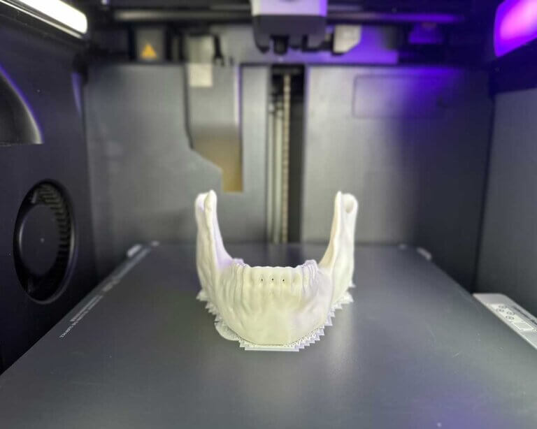 teeth being 3D printed