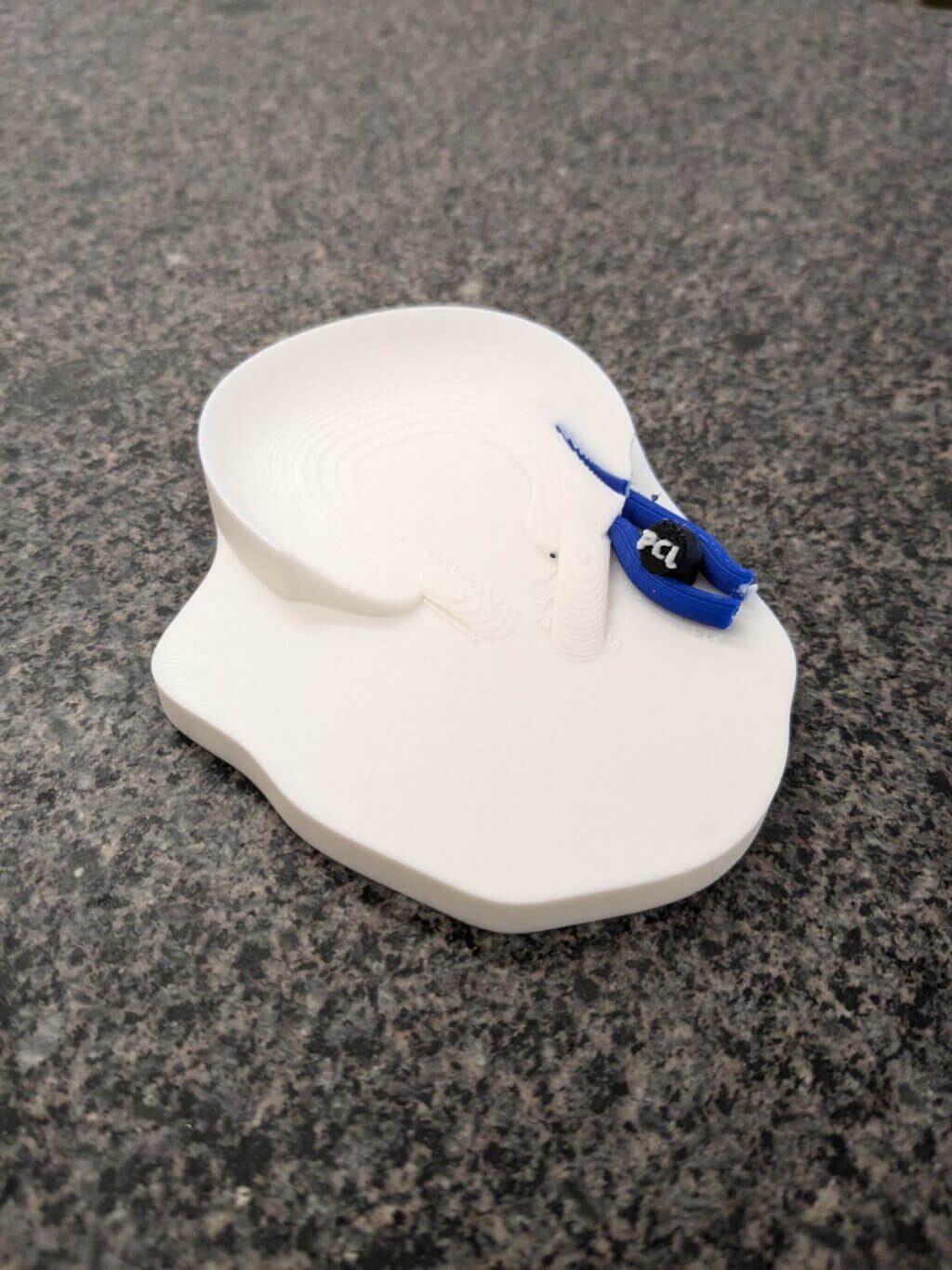 3D printed model of a Wrisberg rip injury of the lateral meniscus. The model demonstrates the anatomical relationship of the Wrisberg and Humphry meniscofemoral ligaments (Blue) and the posterior cruciate ligament (Black; PCL) with the posterior horn of the lateral meniscus (White). It explains why excessive forces on the meniscofemoral ligaments rip the meniscus apart in a longitudinal vertical pattern of injury.