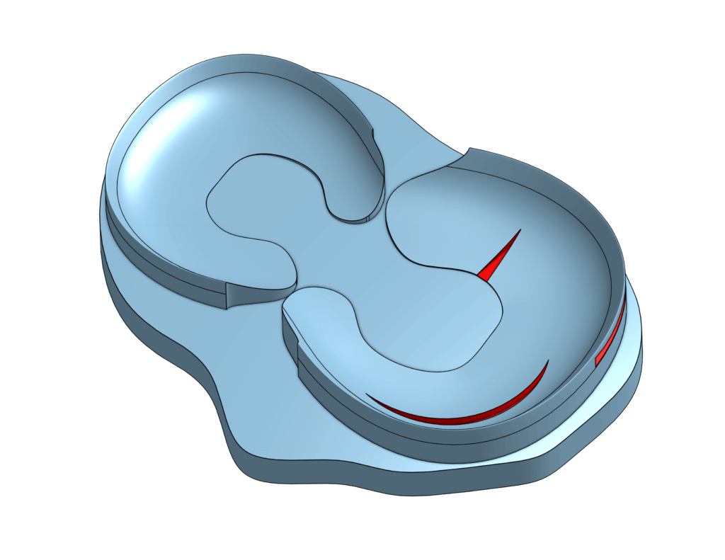 Ilan's early attempts of modeling Wrisberg rips in OnShape