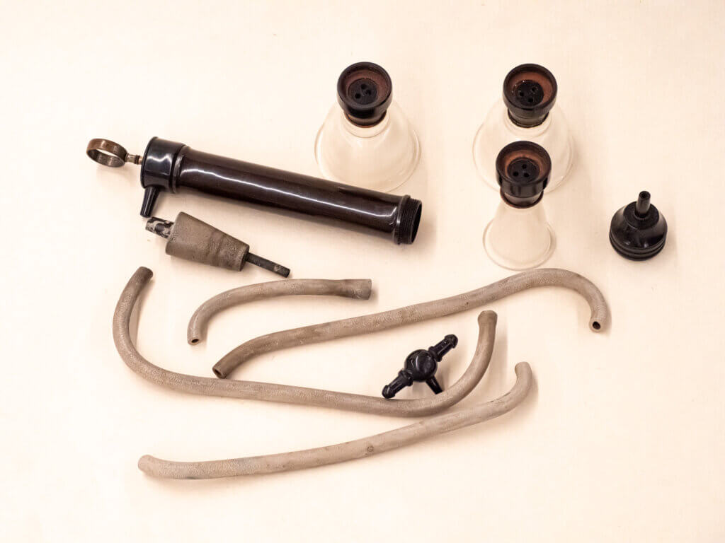 Black’s Patent Cupping Apparatus, Breast Pump, Aspirator and Stomach Pump