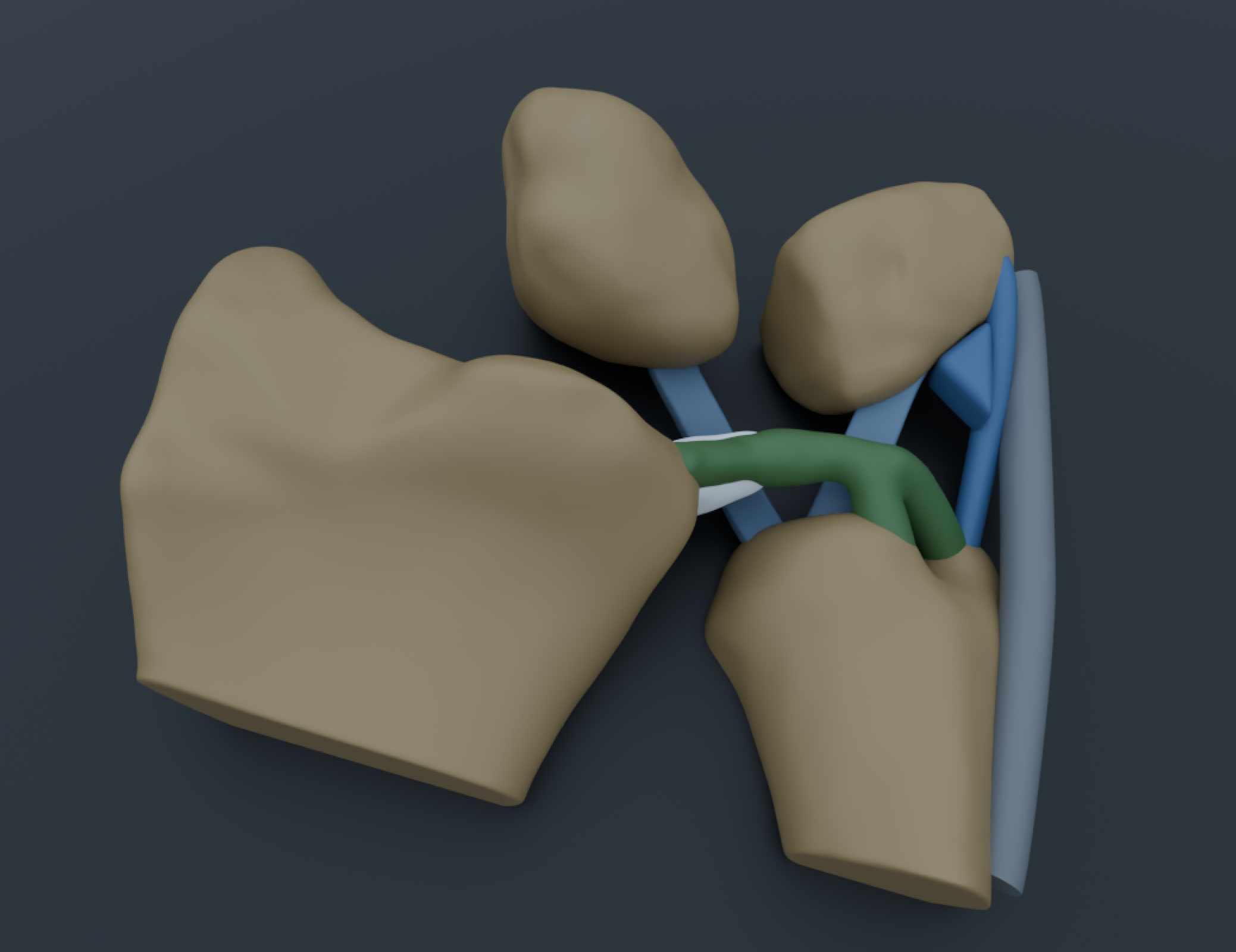 Triangular fibrocartilage complex (TFCC) of the wrist injury model render created in Blender.
