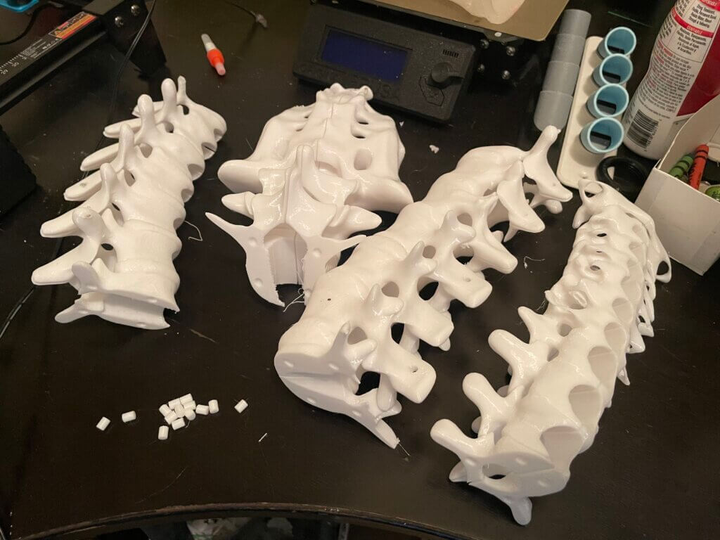 3D-printed Spine parts with dowels