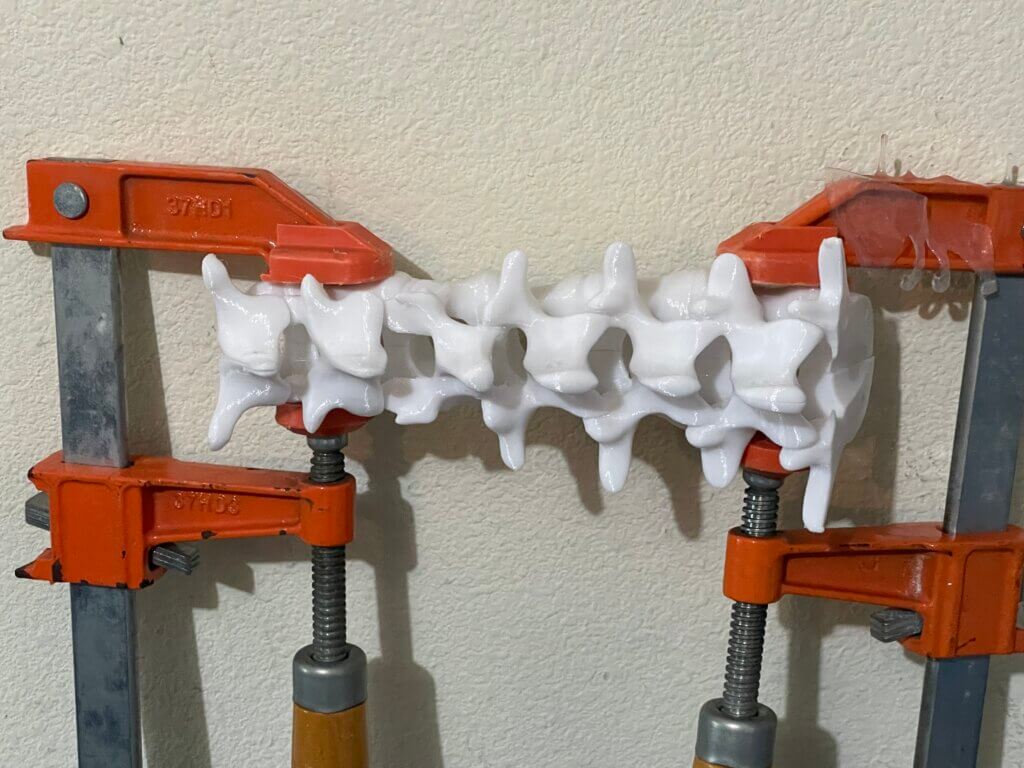 Central section of the 3D-printed spine clamped together