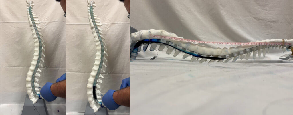 Gloved hands injecting blue liquid into a clear tube. The spine is in a vertical position and then rotated horizontally.