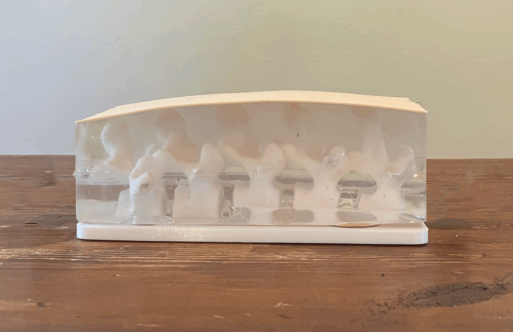 Lumbar puncture prototype with vertebra visible and tattoo skin sitting on a table.
