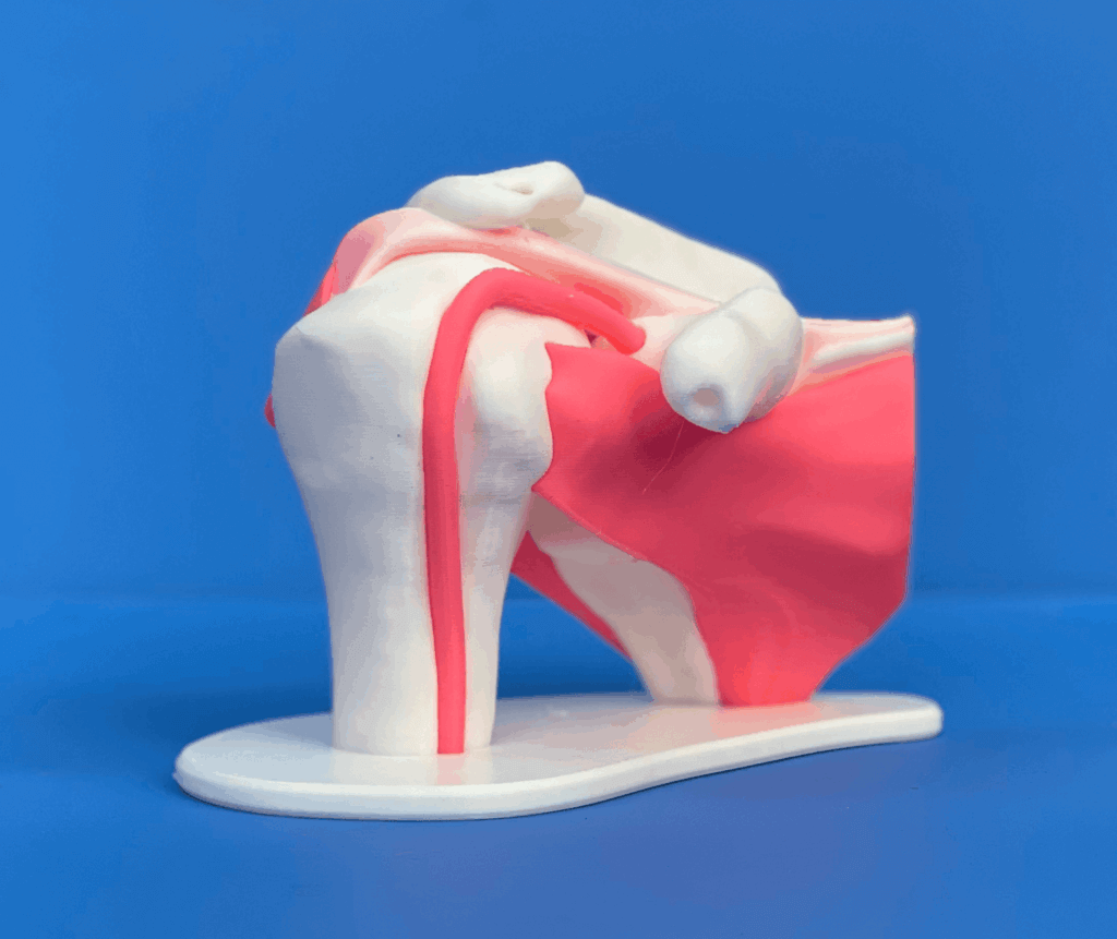 3D-printed anatomical shoulder model in white plastic and pink silicone.
