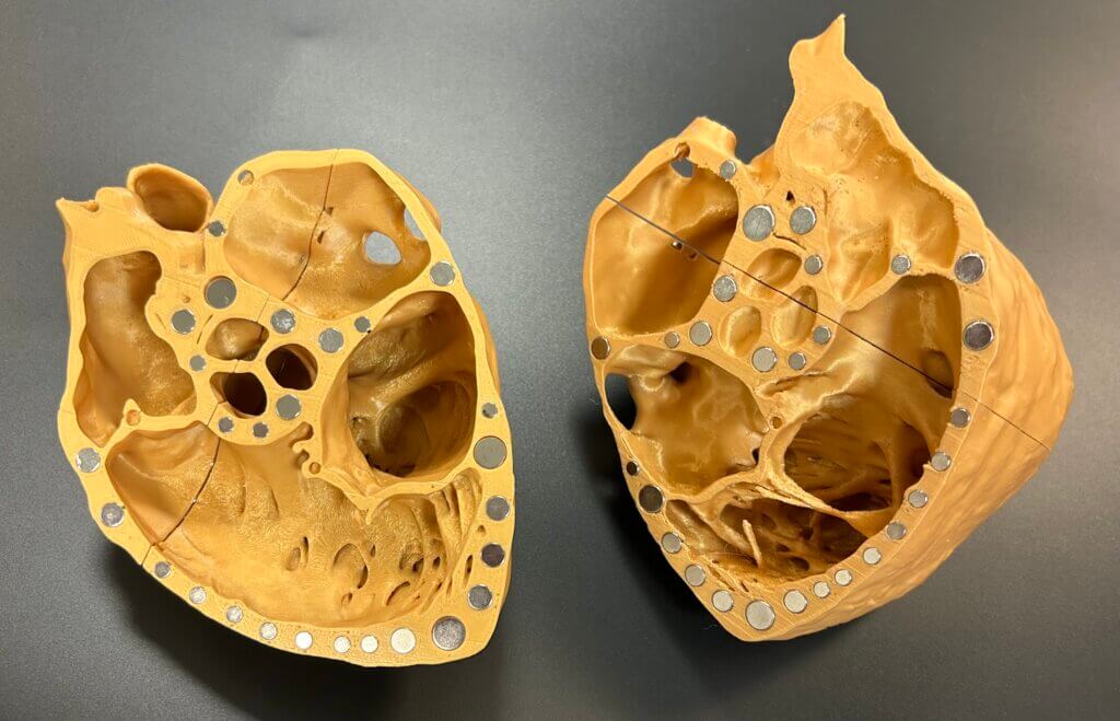 A gold version of the 3D printed heart model split in half to reveal the ME SAX (Mid-Esophageal Short-Axis) view