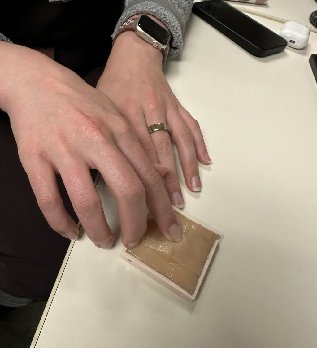 Close-up of a dermatologist's hands pressing firmly on one of the silicone lipoma models covered with silicone bandage material.