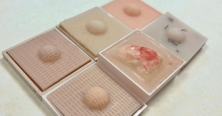 Close up photo of 6 square shaped skin condition trays holding silicone cyst and lipoma models of varying condition.