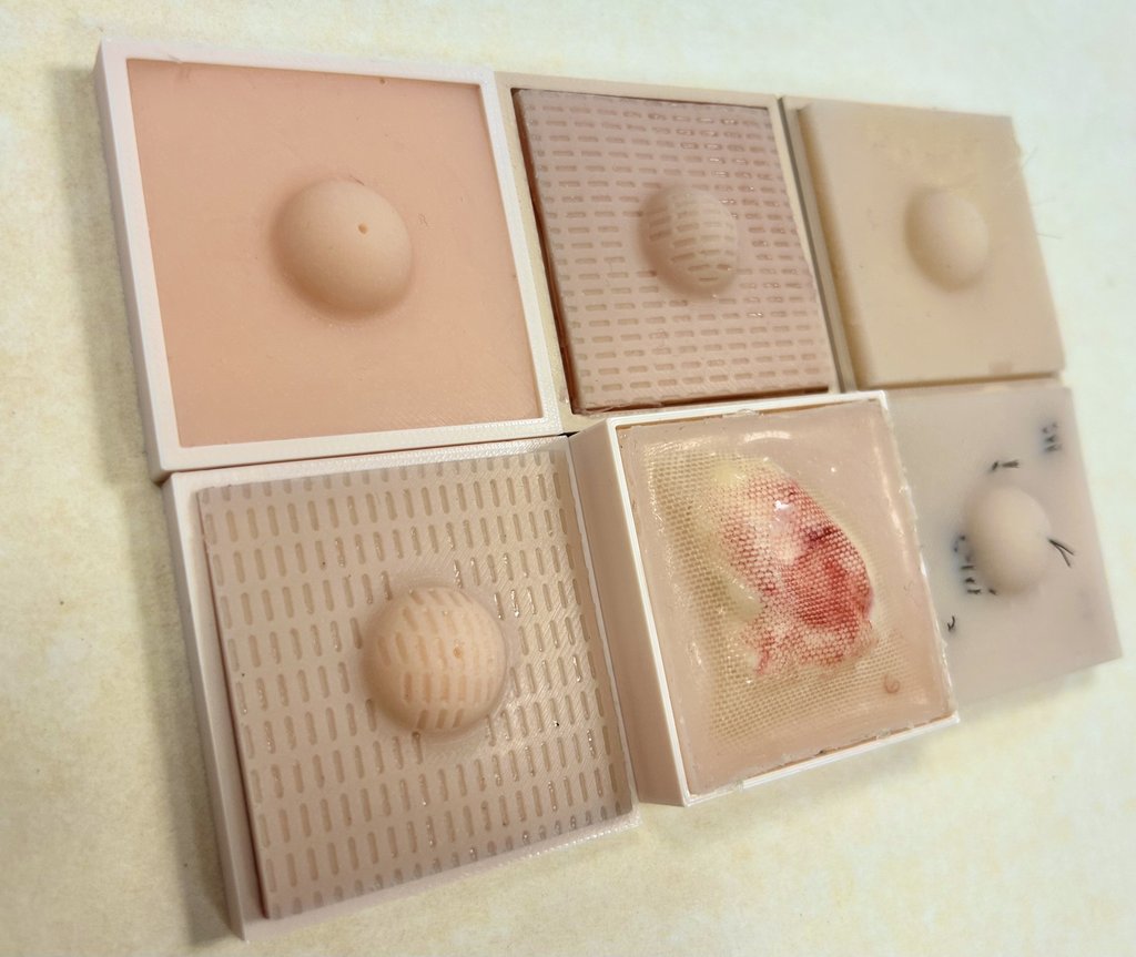 Close up photo of 6 square shaped skin condition trays holding silicone cyst and lipoma models of varying condition.