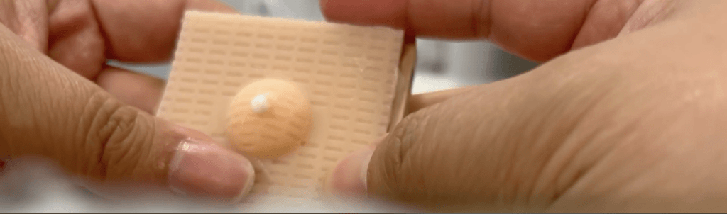 Close up of two hands holding a textured silicone cyst model that is oozing lotion.